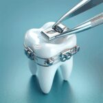 Exodontia e Classificação Internacional de Doenças (CID): Guia Completo para Profissionais de Odontologia