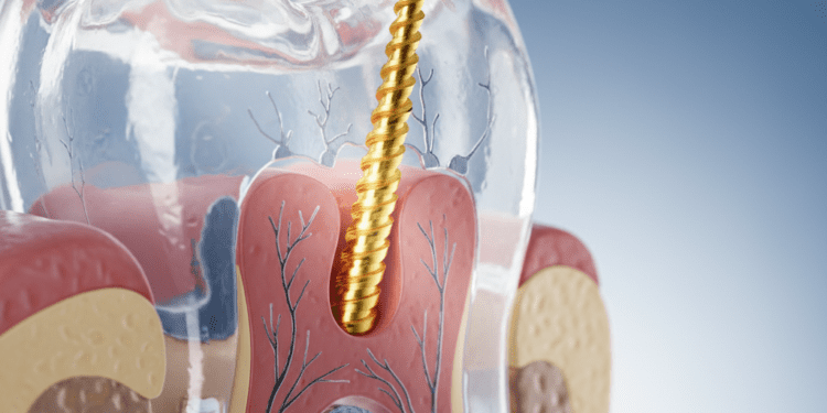 a importancia da anatomia interna no sucesso endodontico