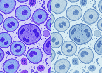 analise citoquimica de rna basofilia e digestao por ribonuclease