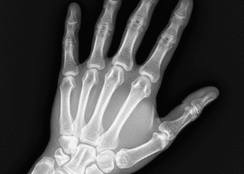 caracteristicas de uma radiografia de qualidade