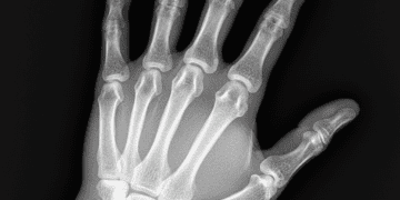 caracteristicas de uma radiografia de qualidade