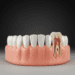 conceitos essenciais de dentes e denticao