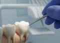diagnostico clinico das alteracoes da polpa dentaria
