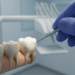 Diagnóstico Clínico das Alterações da Polpa Dentária: Guia Completo 8 diagnostico clinico das alteracoes da polpa dentaria