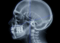 linhas de posicionamento facial em radiografia