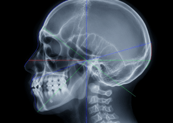linhas de posicionamento facial em radiografia