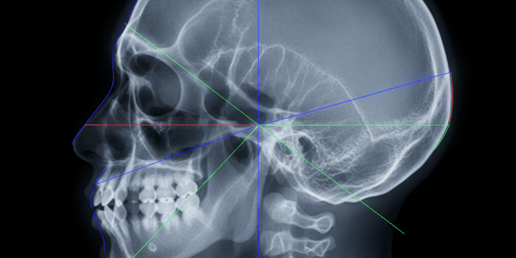 linhas de posicionamento facial em radiografia