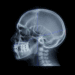 linhas de posicionamento facial em radiografia