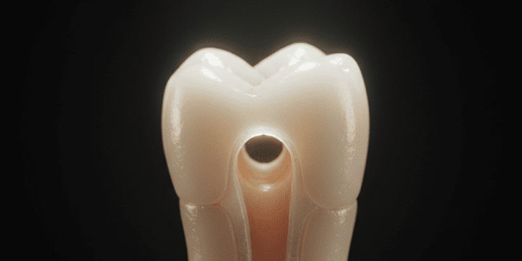 Manutenção da Anatomia Original e Forame Apical: Um Guia Completo 1 manutencao da anatomia original e forame apical