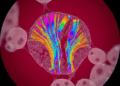 microscopia de polarizacao na citologia analise de estruturas birrefringentes