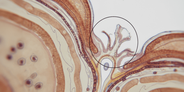 Modelagem Longitudinal Cervicoapical e Limite Apical: Uma Abordagem Eficiente na Endodontia 1 modelagem longitudinal cervicoapical e limite apical