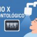 Raio X Odontológico: O Guia Completo Sobre Sua Importância, Tipos, Benefícios e Cuidados 8 Raio X Odontologico