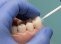 recursos semiologicos para o diagnostico endodontico