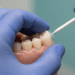 Recursos Semiológicos para o Diagnóstico Endodôntico: Um Guia Completo 8 recursos semiologicos para o diagnostico endodontico