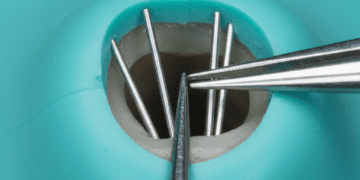 remocao de cones de prata em retratamento endodontico