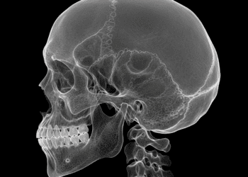 telerradiografia e cefalometria cranio em perfil