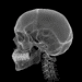 telerradiografia e cefalometria cranio em perfil